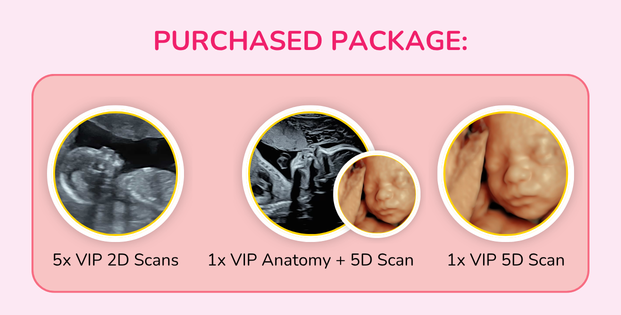 VIP Anatomy Screening + 4D or 5D Scan