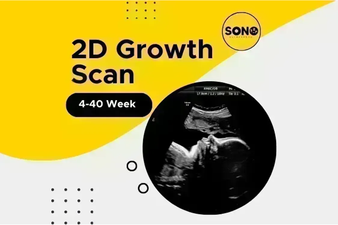 2D Growth Scan Malaysia