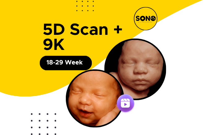 5D Scan + 9K Baby Motion 