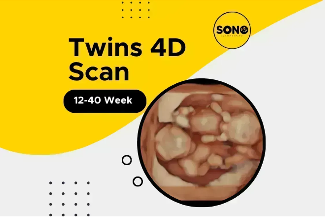 Twins 4D Scan