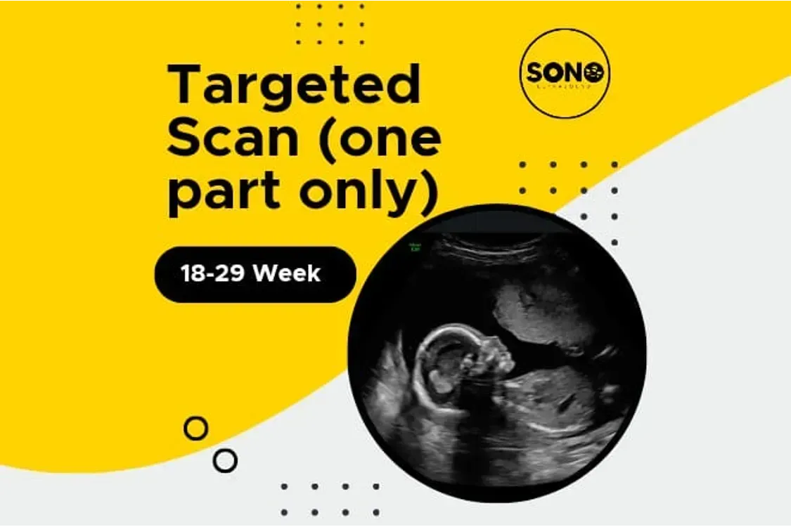 Targeted Scan