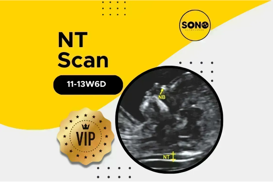 VIP NT Scan