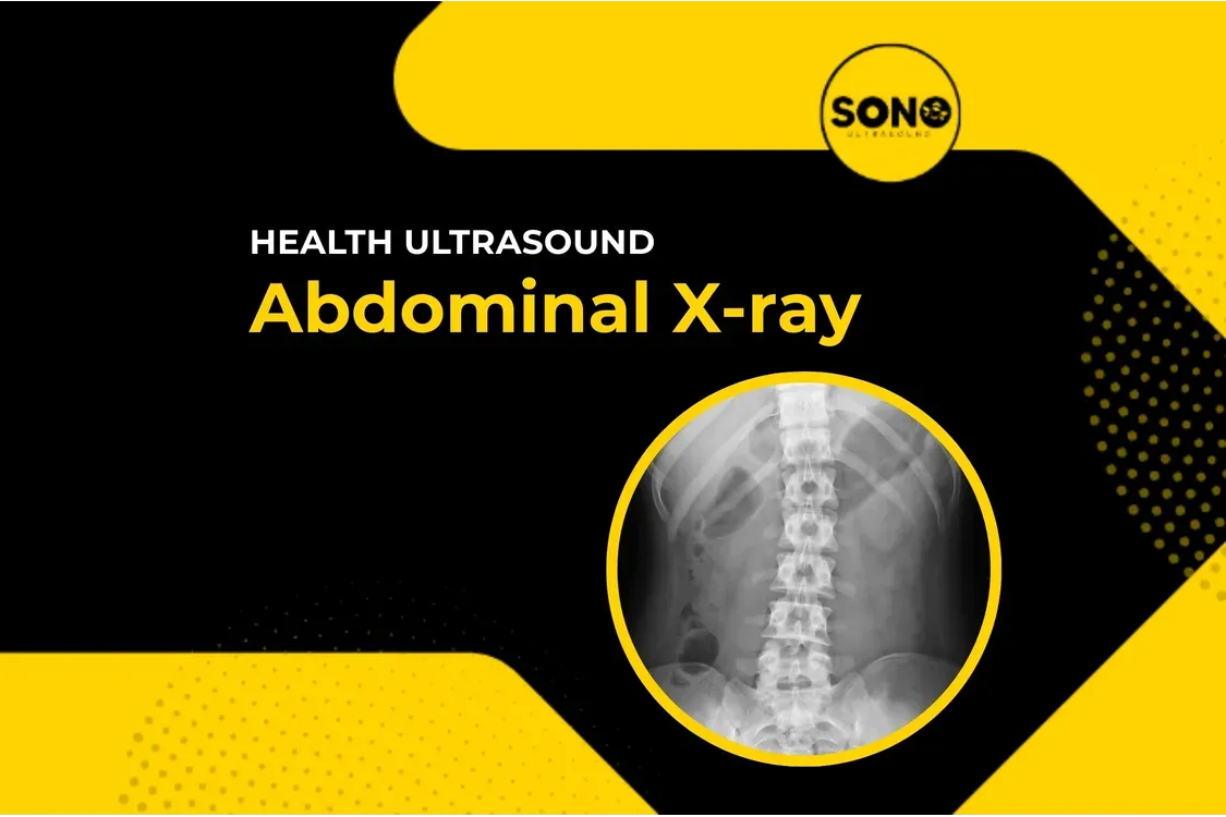 Abdominal X-Ray – Fast & Accurate Imaging