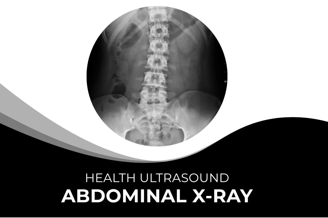 Abdominal X-Ray – Fast & Accurate Imaging