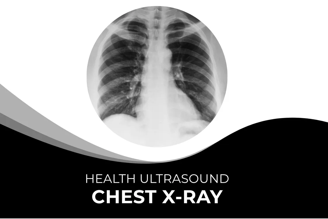 Chest X-Ray – Fast & Accurate Imaging