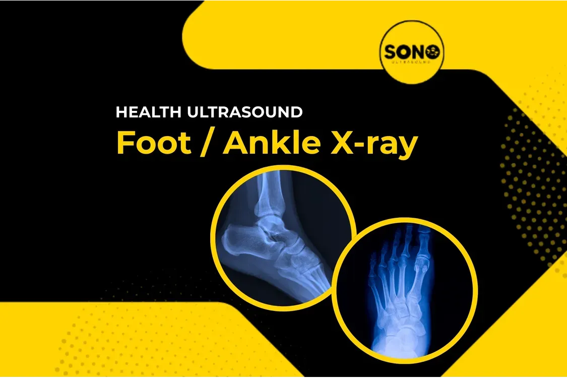 Foot / Ankle X-Ray – Fast & Accurate Imaging