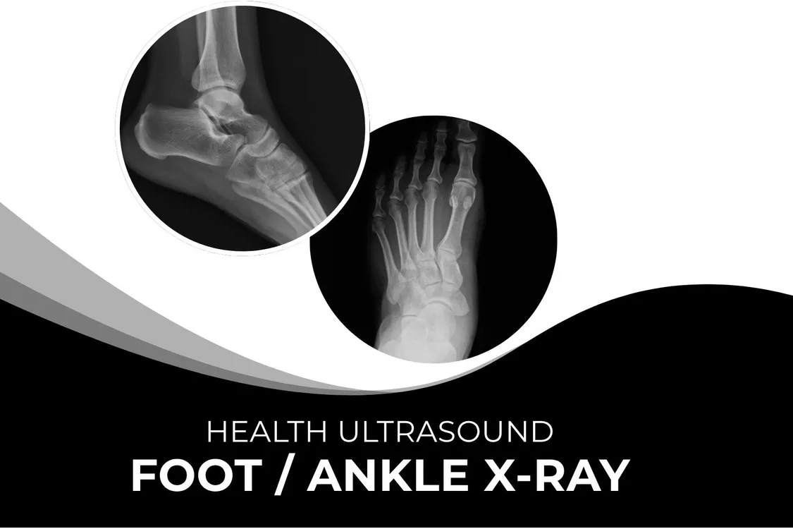 Foot or Ankle X-Ray – Fast & Accurate Imaging