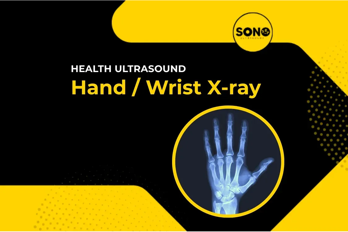 Hand / Wrist X-Ray – Fast & Accurate Imaging