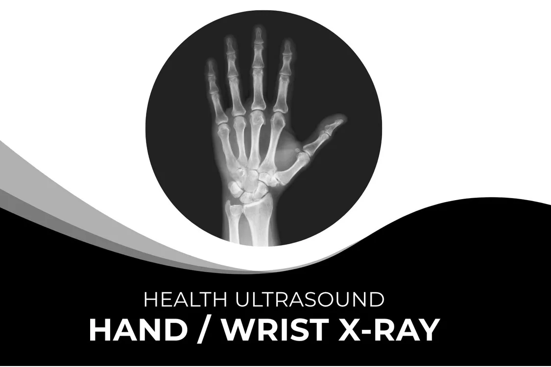 Hand or Wrist X-Ray – Fast & Accurate Imaging