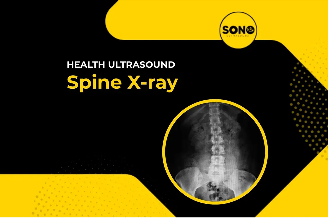 Spine X-Ray – Fast & Accurate Imaging