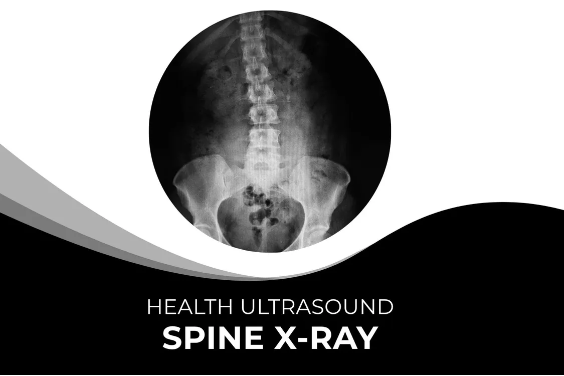 Spine X-Ray – Fast & Accurate Imaging